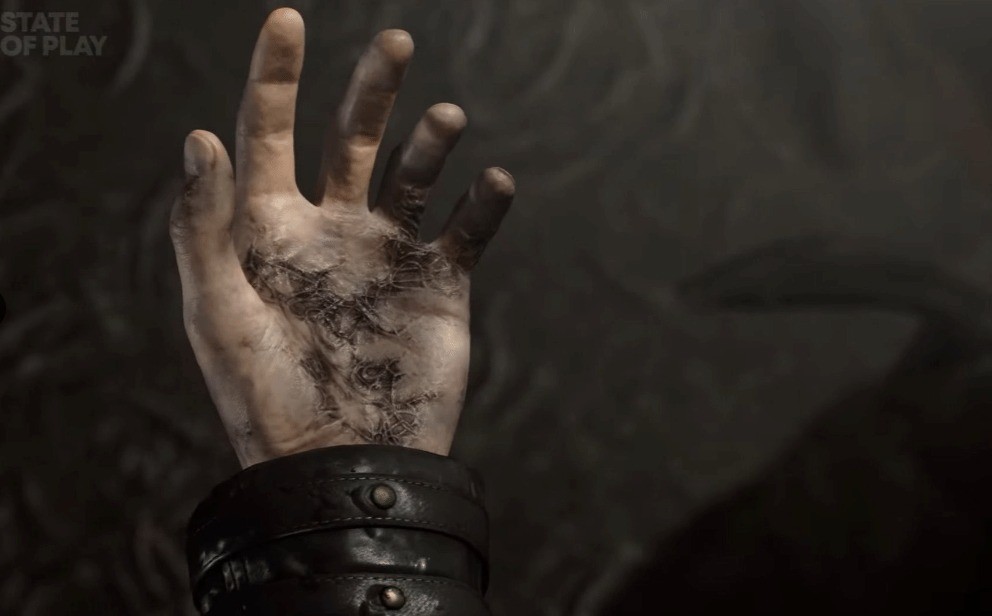 里昂危险了?《生化危机9》新细节:新病毒不变异只致死(图1) 里昂危险了?《生化危机9》新细节:新病毒不变异只致死